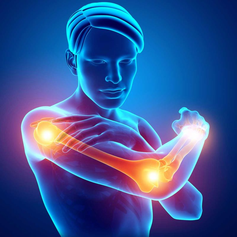 Evaluation And Treatment Of The Upper Extremity - BayGrass Institute